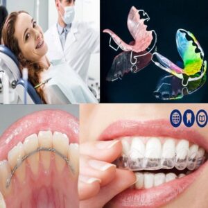 Curso Teórico e Demonstrativo de Ortodontia para TSB , ASB e Iniciantes em Odontologia